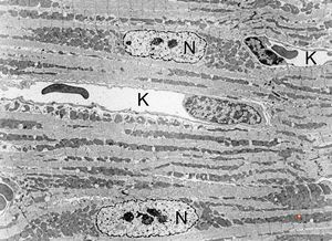 normal myocardium (N … nuclei of cardiomyocytes, K … capillaries) normal myocardium (N … nuclei of cardiomyocytes, K … capillaries)